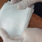 Caring for an open wound