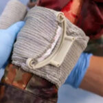 Trauma bandage, what is it and how do you apply it?