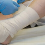 Long stretch bandages, what are they and what are they used for?
