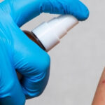 Disinfect the wound